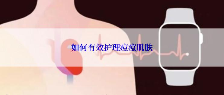 如何有效护理痘痘肌肤